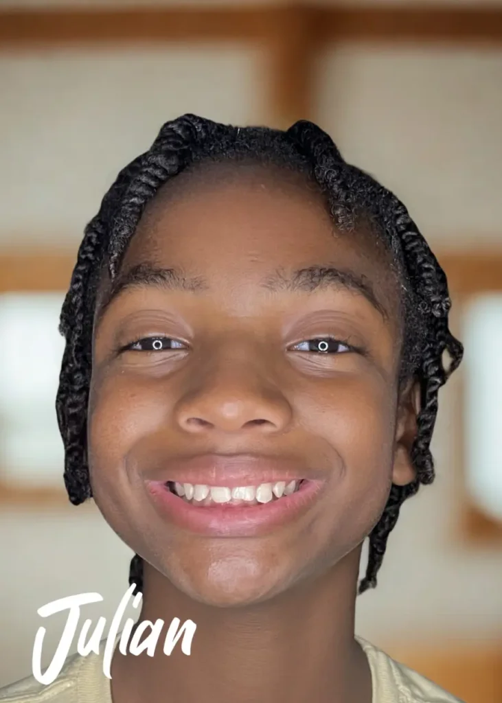 Picture of Blessed Kid Julian Before Treatment