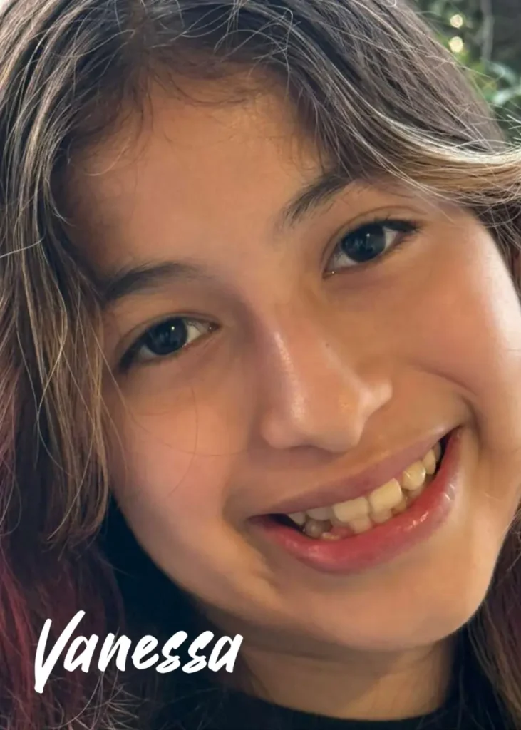 Picture of Blessed Kid Vanessa Before Treatment