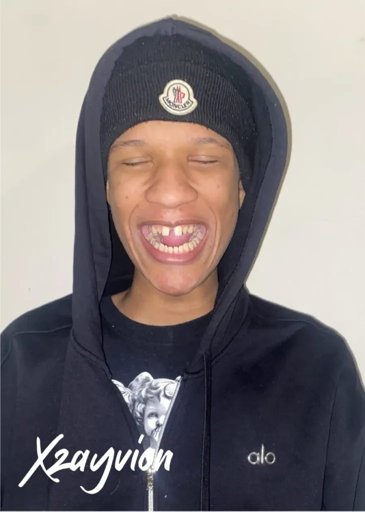 Picture of Blessed Kid Xzayvion Before Treatment