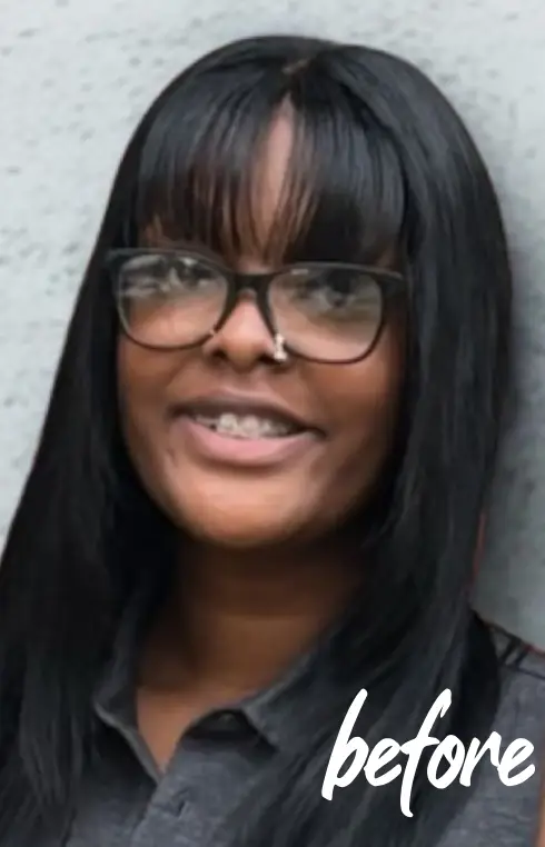 before-takyra-braces-2