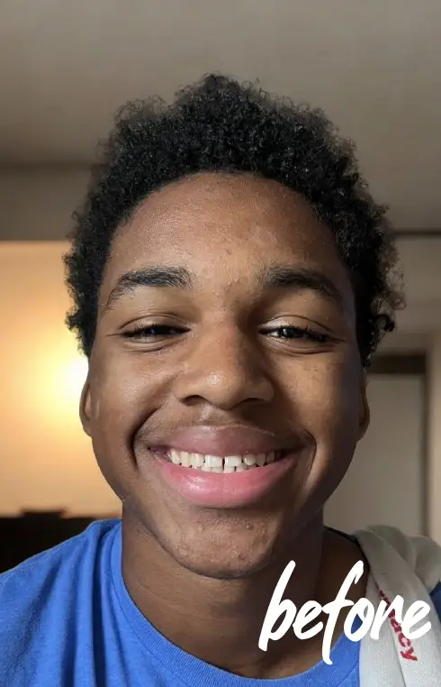 micah-before-braces-blessed