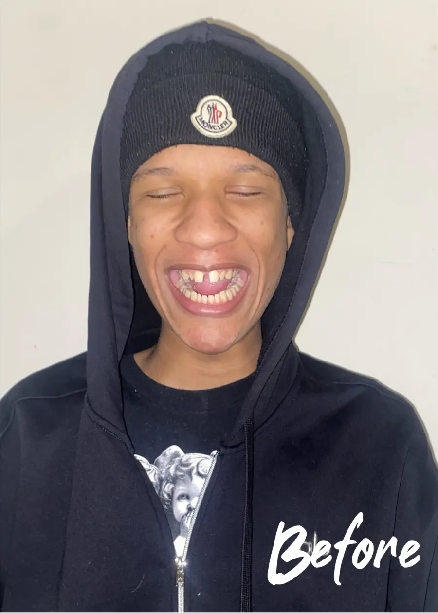 Xzayvion Before Picture