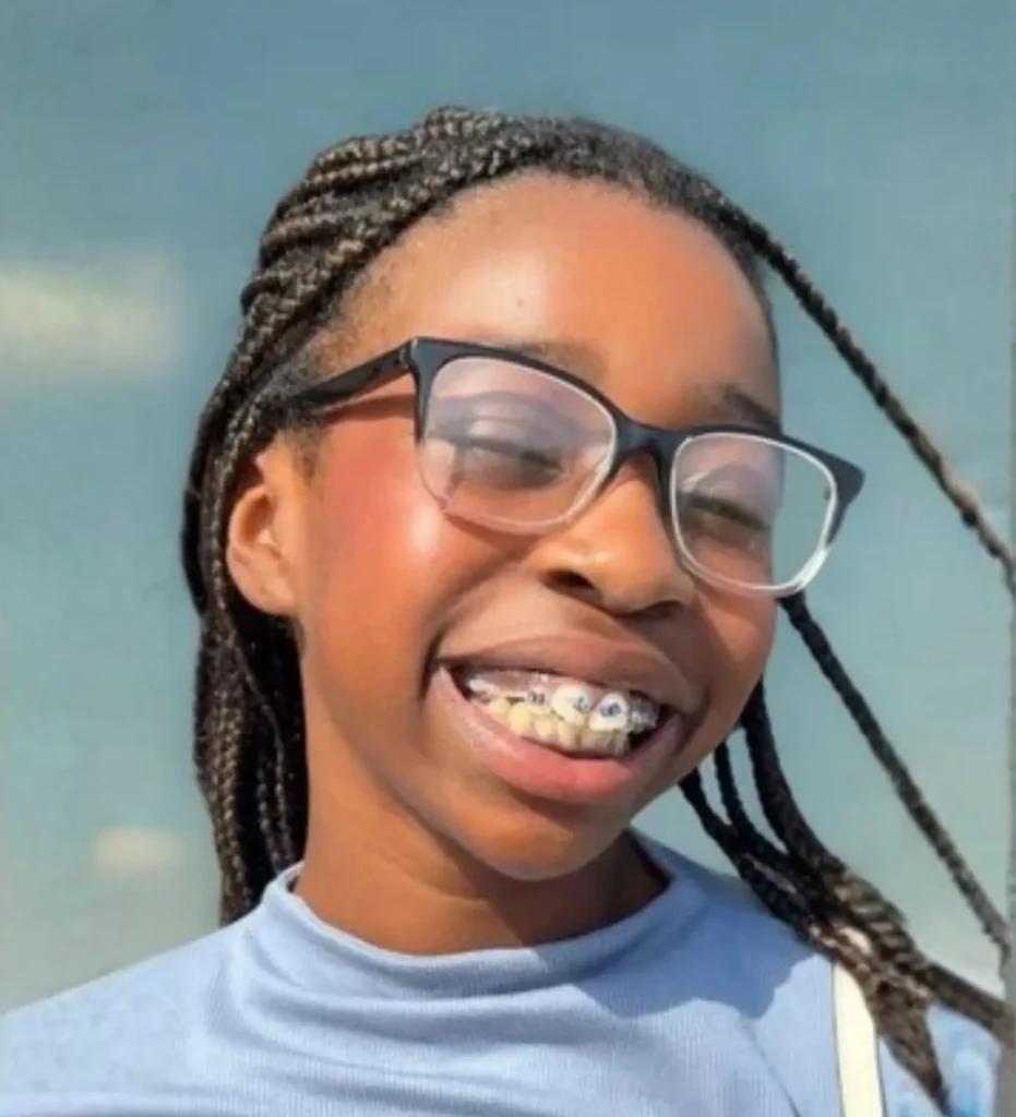 Blessed Kid Emerie Smiling with Braces