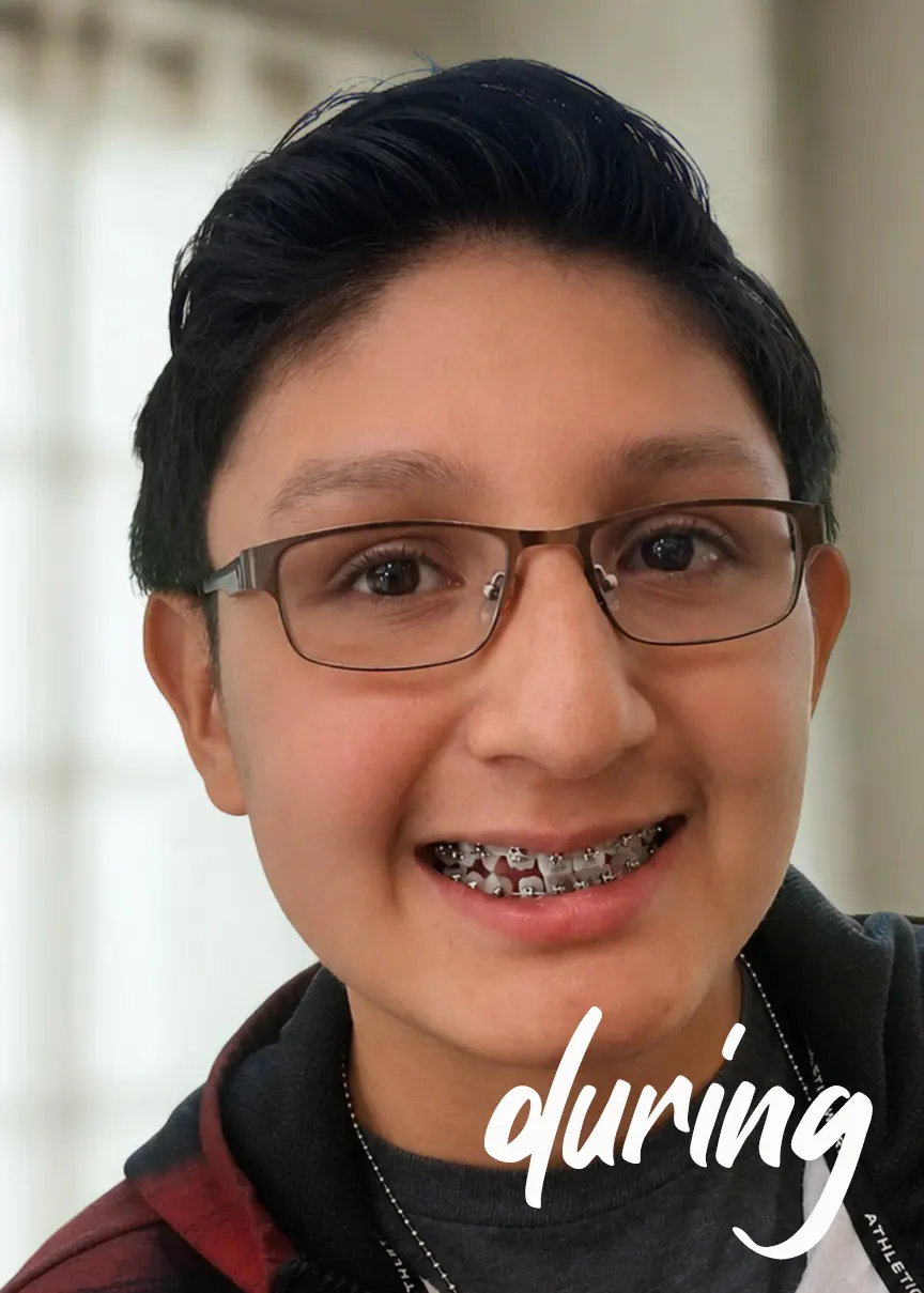 Gustavo-during